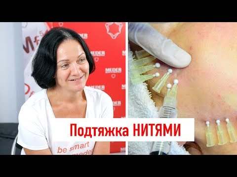 Видео: Подтяжка лица нитями - ваша кожа не тряпка!