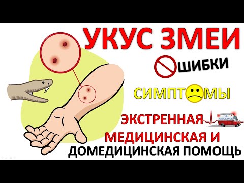 Видео: УКУС ЗМЕИ: Экстренная медицинская и Домедицинская помощь; Ошибки и заблуждения; Симптомы и патогенез