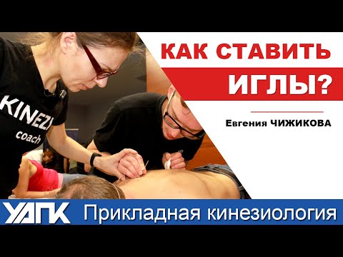 Видео: Как ставить иглы правильно? (Е.Чижикова)