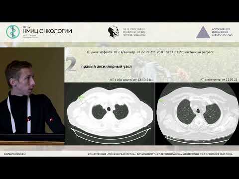 Видео: Опыт лечения иммуноопосредованных нежелательных явлений в реальной клинической практике