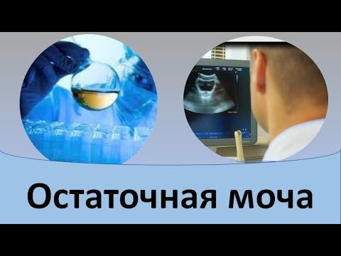 Видео: Остаточная моча