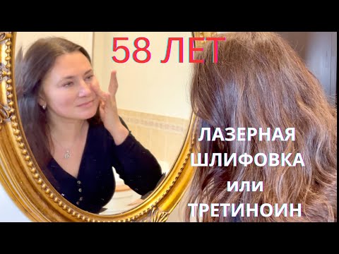 Видео: ЛАЗЕРНАЯ ШЛИФОВКА  ИЛИ ТРЕТИНОИН, ЧТО ЭФФЕКТИВНЕЕ ?