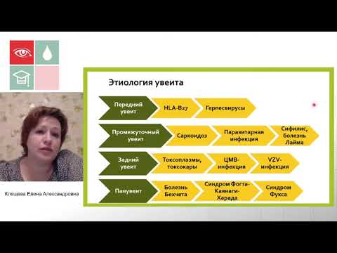 Видео: Некоторые аспекты диагностики и терапии увеитов
