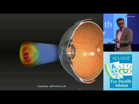 Видео: Мультифокальные линзы: как сделать, чтобы они "работали"
