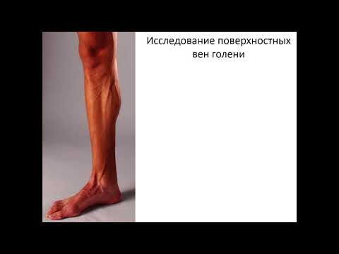 Видео: Методика УЗИ вен НК