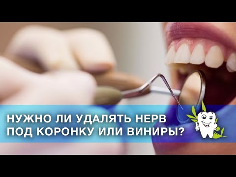 Видео: Нужно ли удалять нерв под коронку или виниры? / Препарирование зубов / Удаление нерва