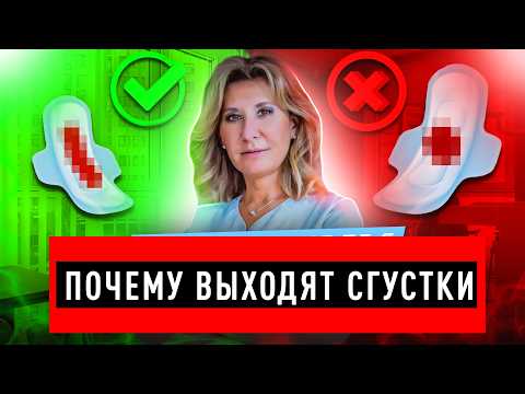 Видео: Менструация со сгустками: что это значит и когда волноваться? / Сгустки при месячных. Что делать?