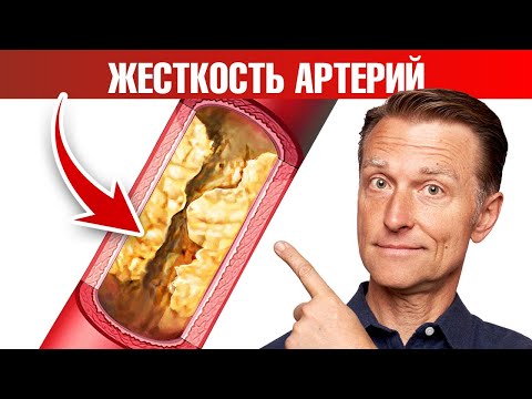 Видео: Кальцификация сосудов, жесткость артерий 👉 причина №1
