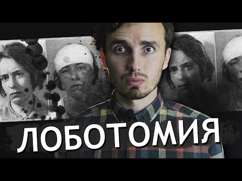 Видео: Лоботомия - [История Медицины]