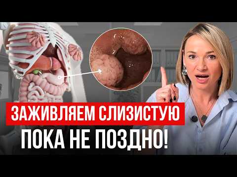 Видео: Самые БЫСТРЫЕ способы заживления ЖКТ без таблеток. ГАСТРИТ. ЯЗВА ЖЕЛУДКА. ИЗЖОГА. ГЭРБ