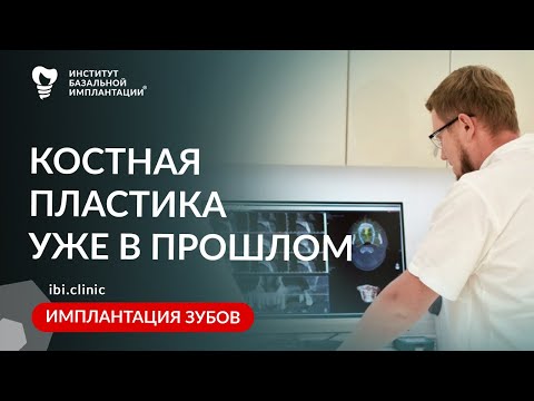 Видео: Почему при ИМПЛАНТАЦИИ ЗУБОВ до сих пор делают КОСТНУЮ ПЛАСТИКУ