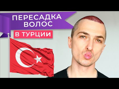 Видео: Я Сделал Пересадку Волос В Турции! Сколько Стоит в 2024? Мой опыт | Клиника Мемориал