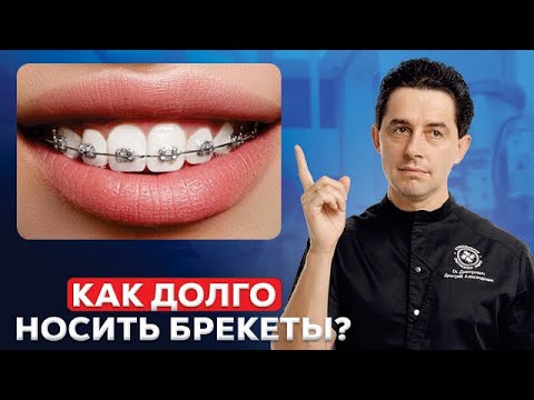 Видео: Сколько времени нужно носить брекеты ? 5 фактов, влияющих на длительность лечения