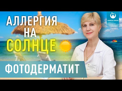 Видео: Фотодерматит - что вызывает аллергию на солнце? Какие проявления? Как с ним бороться?