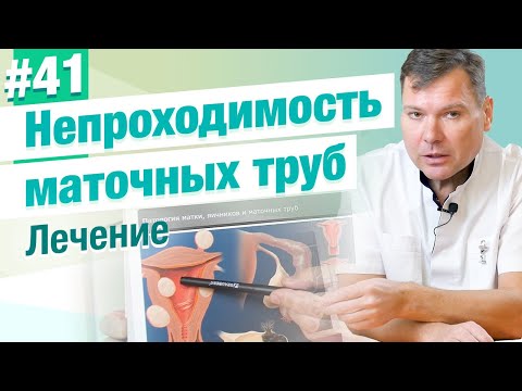 Видео: Непроходимость маточных труб. Лечение. В каких случаях возможно? Лапароскопия. Лапаротомия. ЭКО