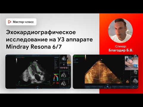 Видео: Эхокардиографическое исследование на УЗИ аппарате Mindray Resona 6/7. Благодир Б.В.