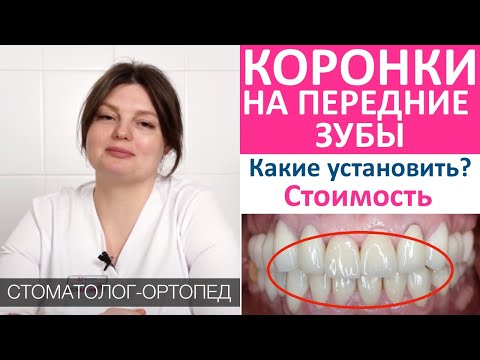 Видео: Зубные коронки на передние зубы: какие установить? Виды коронок для зубов, материалы, цена, гарантия