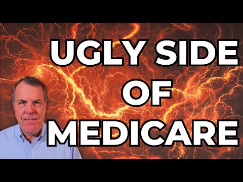 Видео: Отрицательная сторона Medicare: что вам следует знать