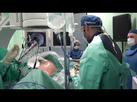 Видео: Микро-ПНЛТ. Оператор: Емельяненко А.В. EndoUroCenter
