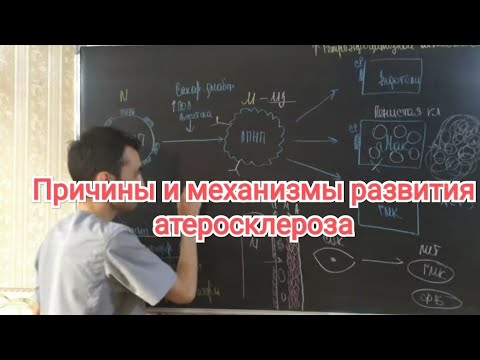 Видео: Атеросклероза. Причины и механизмы развития. Нарушение холестеринового обмена.