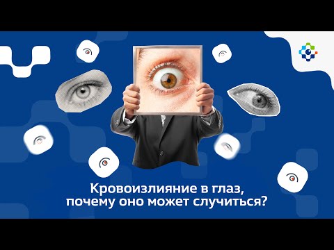 Видео: Гемофтальм. Кровоизлияние в глаз, почему оно может случится?