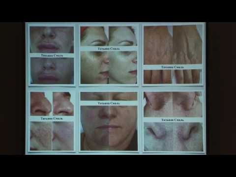 Видео: Т  Смаль. Аспекты применения лазерных технологий в эстетической медицине