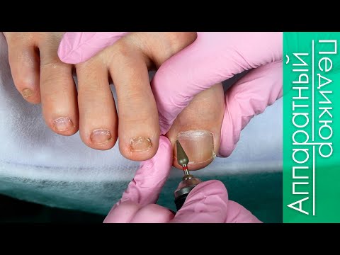 Видео: Мужской Педикюр 🦶 Обработка стопы Смарт Дисками