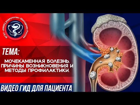 Видео: КАМНИ В ПОЧКАХ | Причины возникновения и методы профилактики.