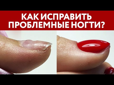 Видео: Клиент с проблемными ногтями! Что делать? | Онихолизис, трапециевидная форма ногтей, ногти трамплин