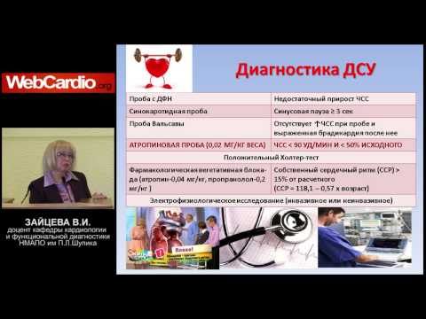 Видео: Синдром слабости синусового узла
