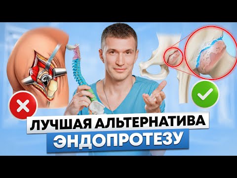 Видео: Новый метод лечения суставов БЕЗ замены на протез!