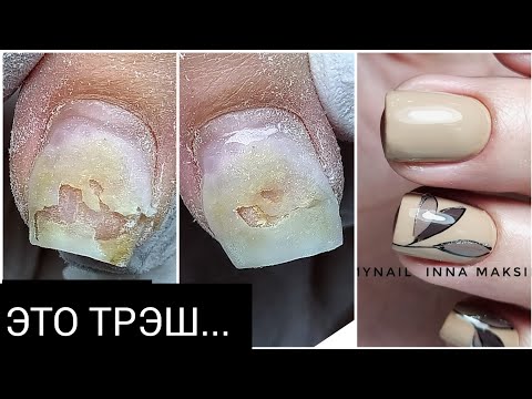 Видео: ВЛАЖНОСТЬ  и ногти