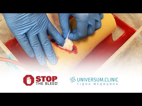 Видео: Тренінг Stop the Bleed | Зупинка кровотечі | Universum.Clinic | Універсум Клінік