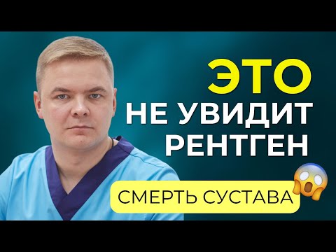 Видео: Асептический некроз или смерть сустава. Как заподозрить и не допустить? Можно ли вылечить?