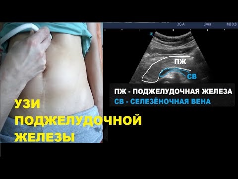 Видео: Как проводиться УЗИ поджелудочной железы?