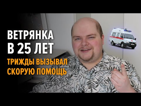 Видео: Как я переболел ветрянкой в 25 лет