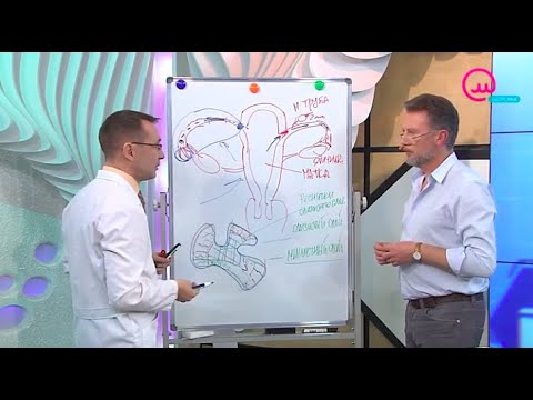 Видео: Доктор знает! Непроходимость маточных труб | Телеканал "Открытый мир. Здоровье"