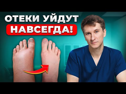 Видео: Как БЫСТРО избавиться от отеков? Настоящие причины застоя лимфы...