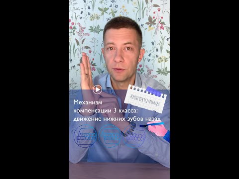 Видео: 6. Механизм компенсации 3 класса:  движение нижних зубов назад. | #конспектсеминара