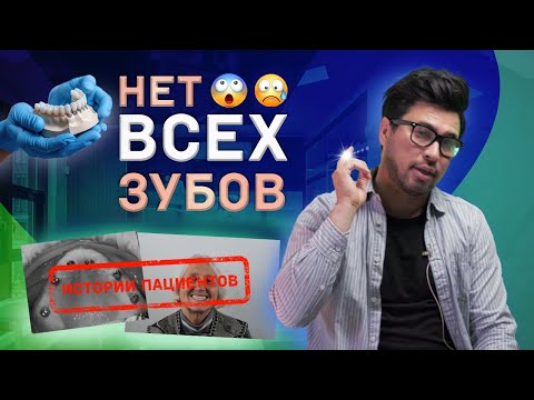 Видео: Когда зубов нет совсем: истории наших самых сложных пациентов