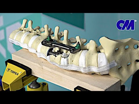 Видео: Мастер класс ОСТЕОМЕД® Секция Вертебрология. Часть 1.