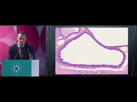 Видео: Концепция интраэпителиальных неоплазий молочной железы