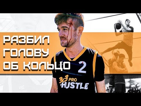 Видео: Разбил Голову на Данк Контесте | Smoove