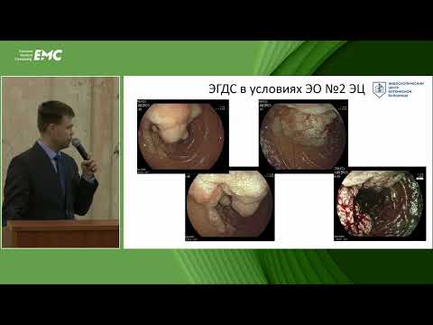 Видео: 1. Балахольцев А.А. Папиллэктомия и резекция гигантской LST-опухоли ДПК. Клинический случай.