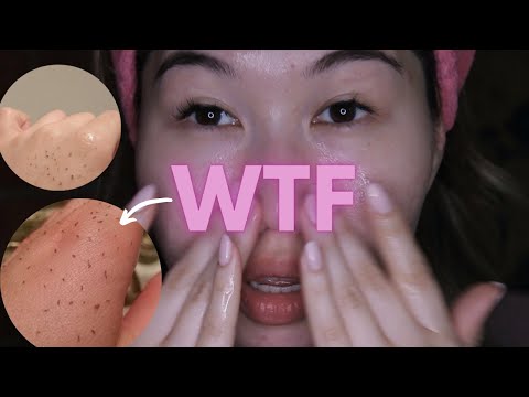 Видео: как вытянуть ЧЁРНЫЕ ТОЧКИ маслом | метод очищения маслом
