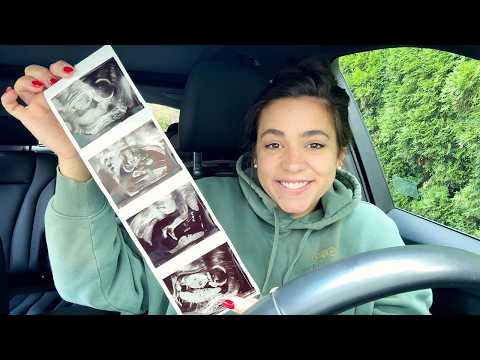 Видео: Эмоциональный обзор беременности с 15 по 22 неделю!