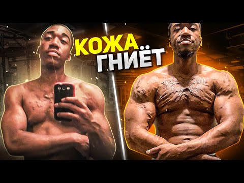 Видео: ГНИЮЩАЯ КОЖА ОТ ХИМИИ / причины, последствия