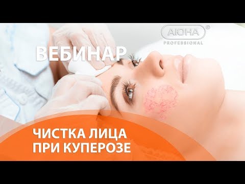 Видео: Чистка лица при КУПЕРОЗЕ и чувствительной коже. Вебинар УЦ АЮНА.