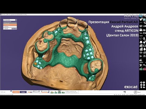 Видео: Презентация Exocad PartialCAD от Андрея Андреева на стенде ARTICON (Дентал Салон 2019)