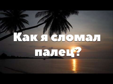 Видео: Как я сломал палец